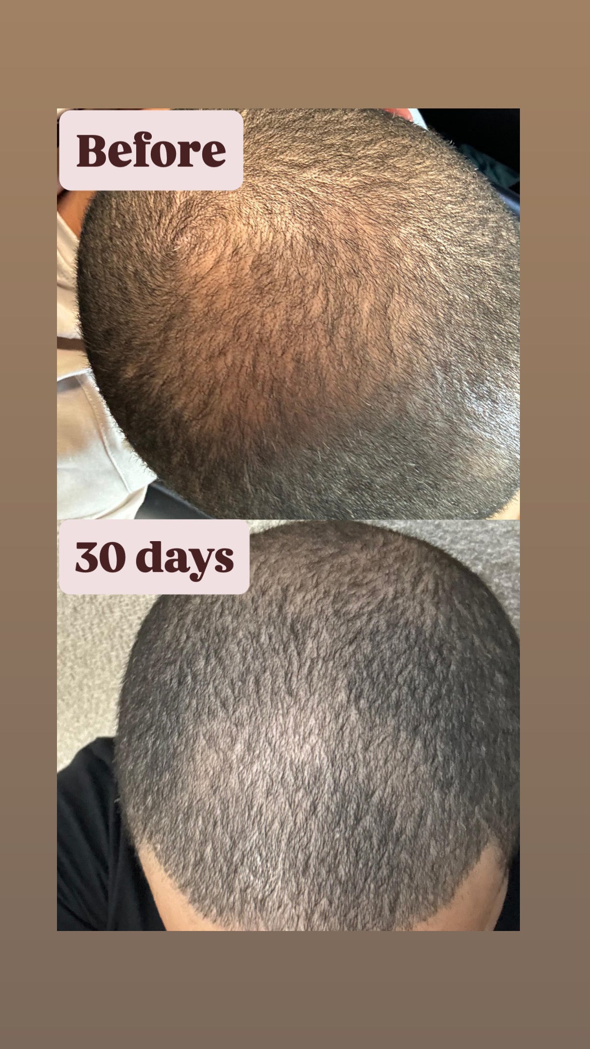 Hair Growth Serum