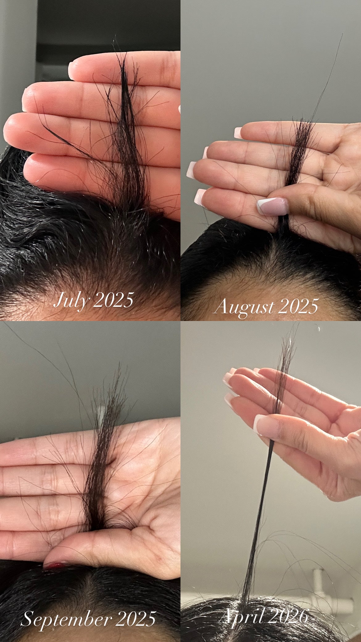 Hair Growth Serum